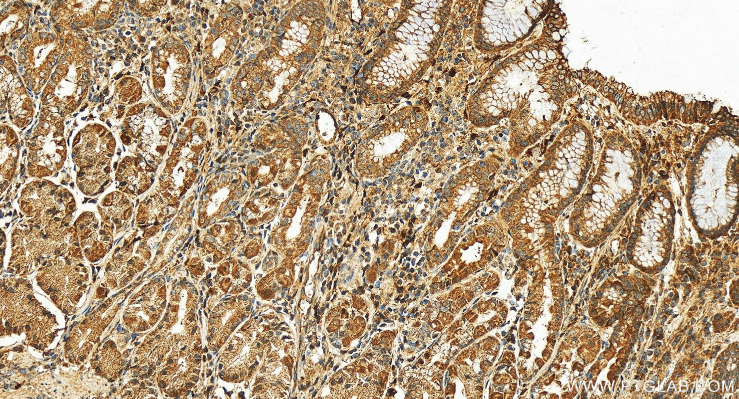 IHC staining of human stomach using 17462-1-AP