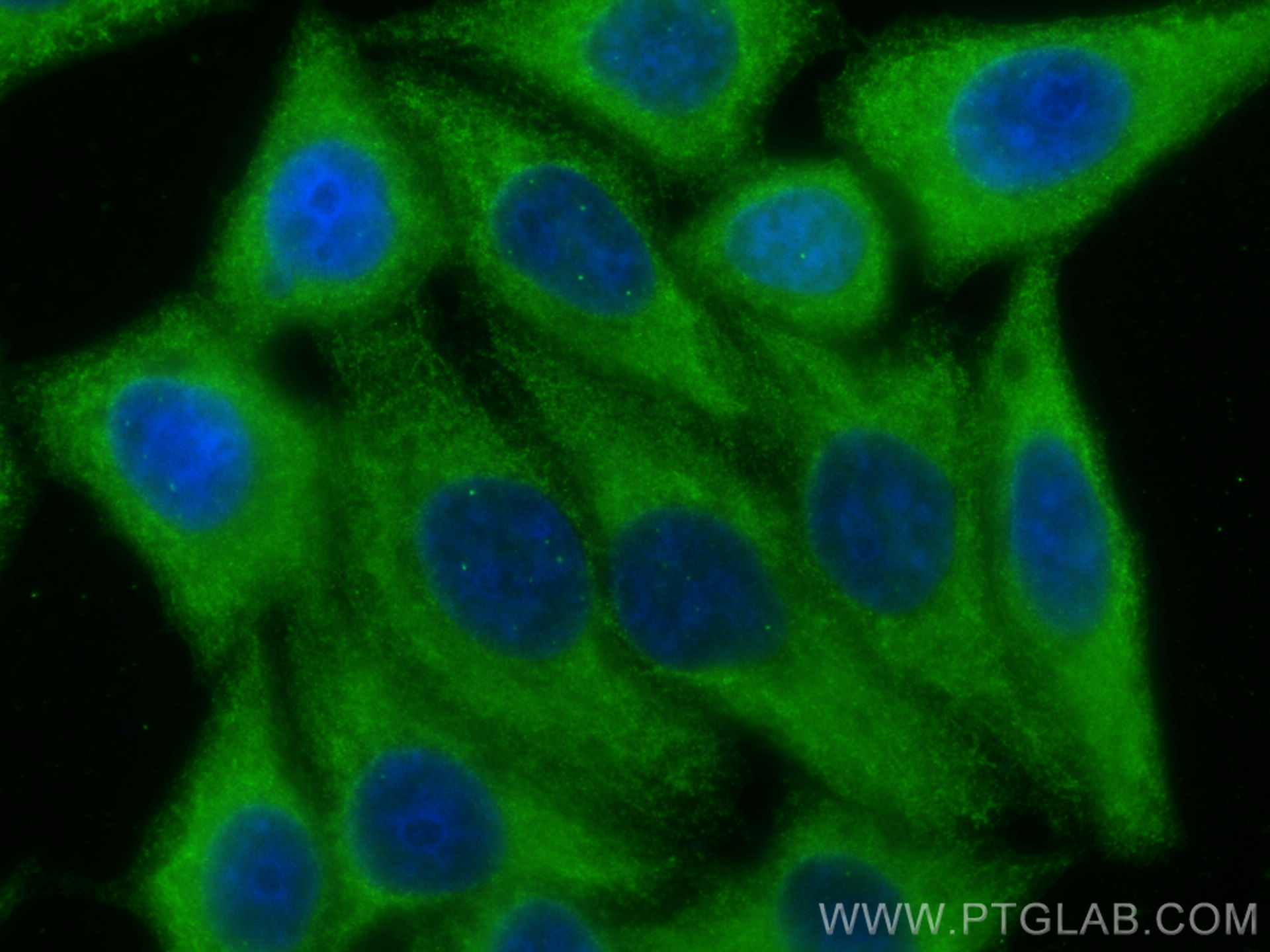 IF Staining of HepG2 using 66399-1-Ig