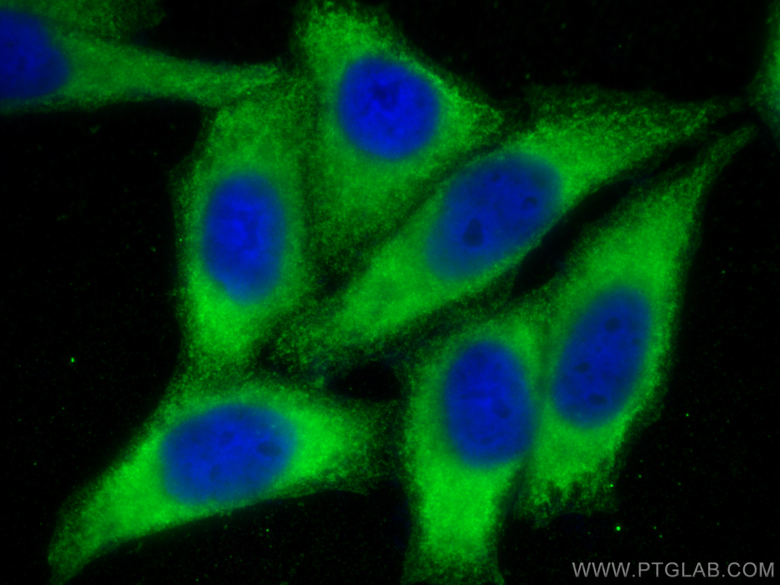 IF Staining of HepG2 using 66399-1-Ig