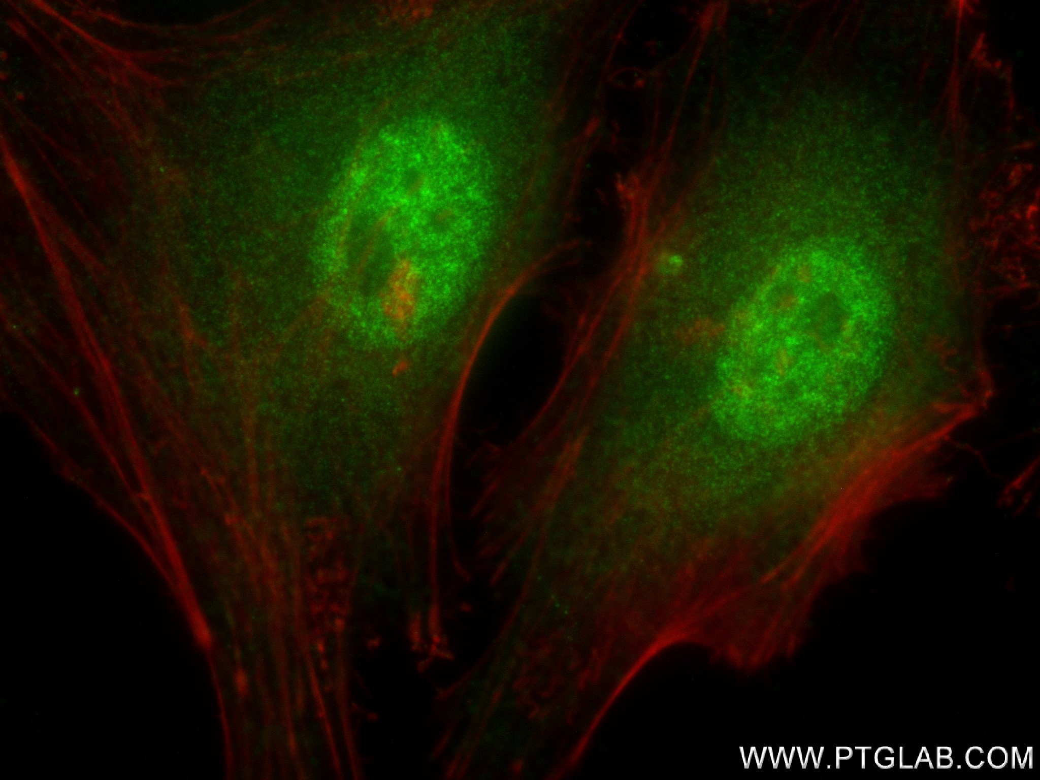 IF Staining of HeLa using 83260-5-RR