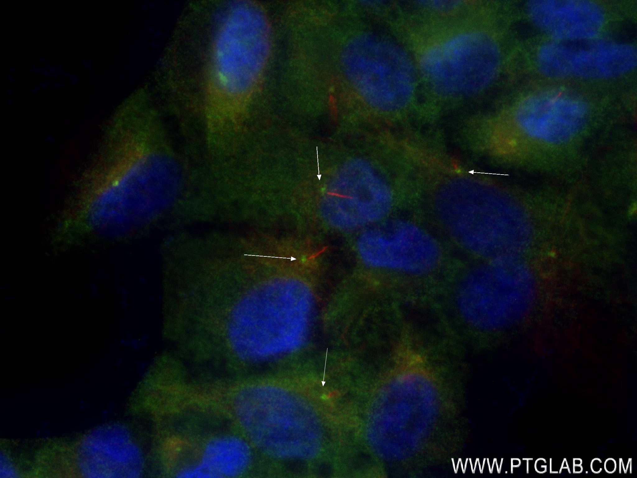 IF Staining of hTERT-RPE1 using 83431-1-RR (same clone as 83431-1-PBS)