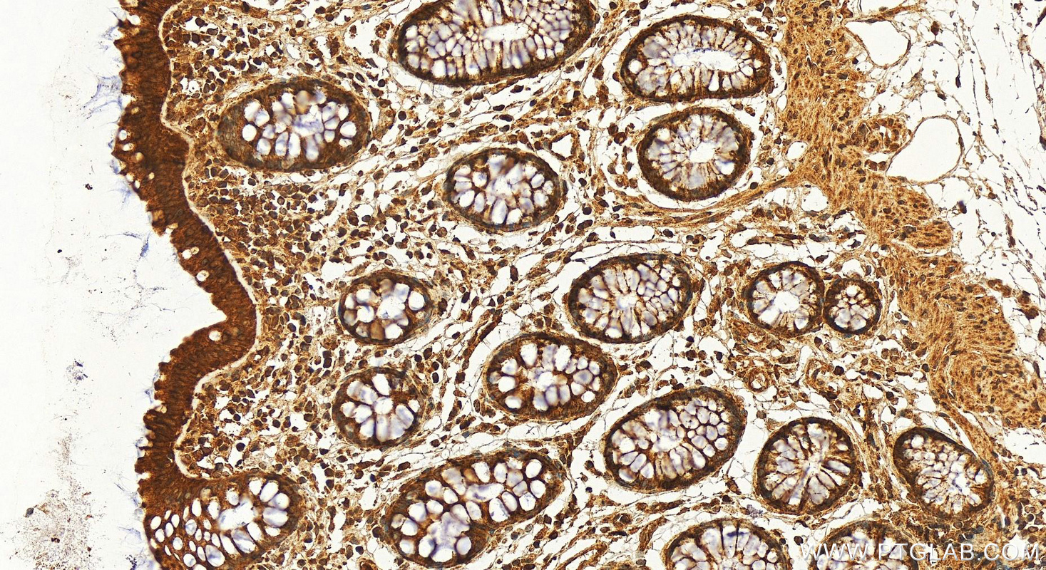 IHC staining of human colon using 30486-1-AP