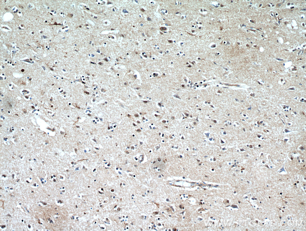 IHC staining of human brain using 21299-1-AP