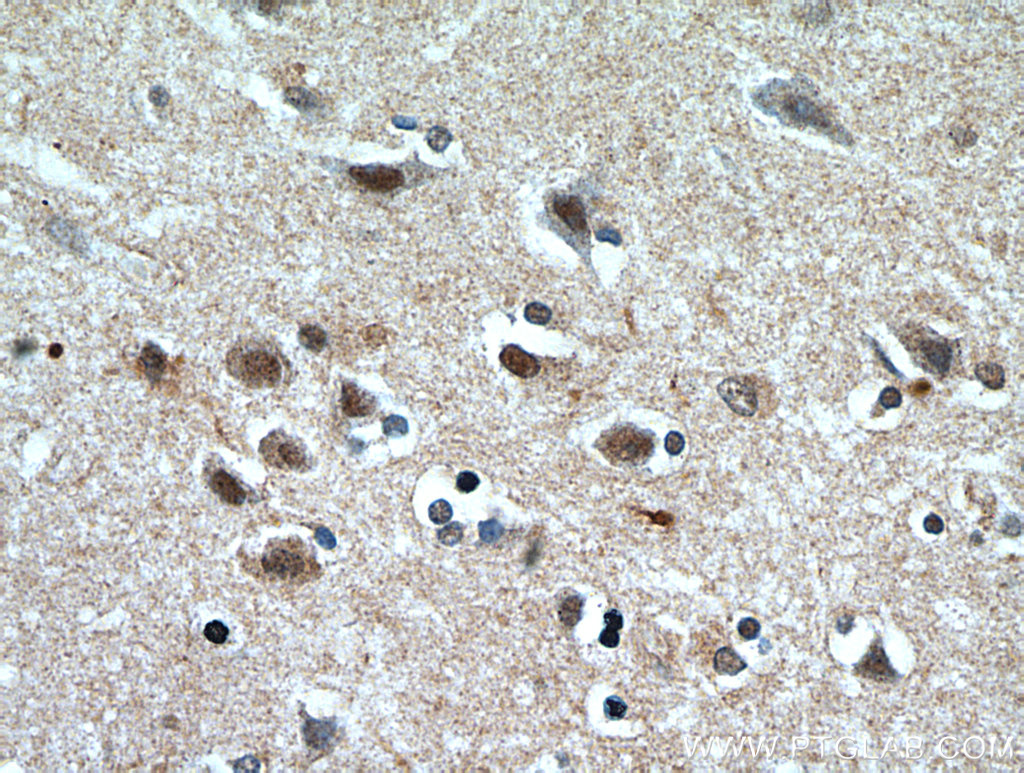 IHC staining of human brain using 21299-1-AP