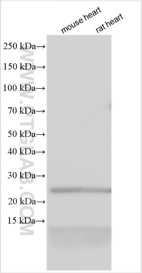 Phospholamban