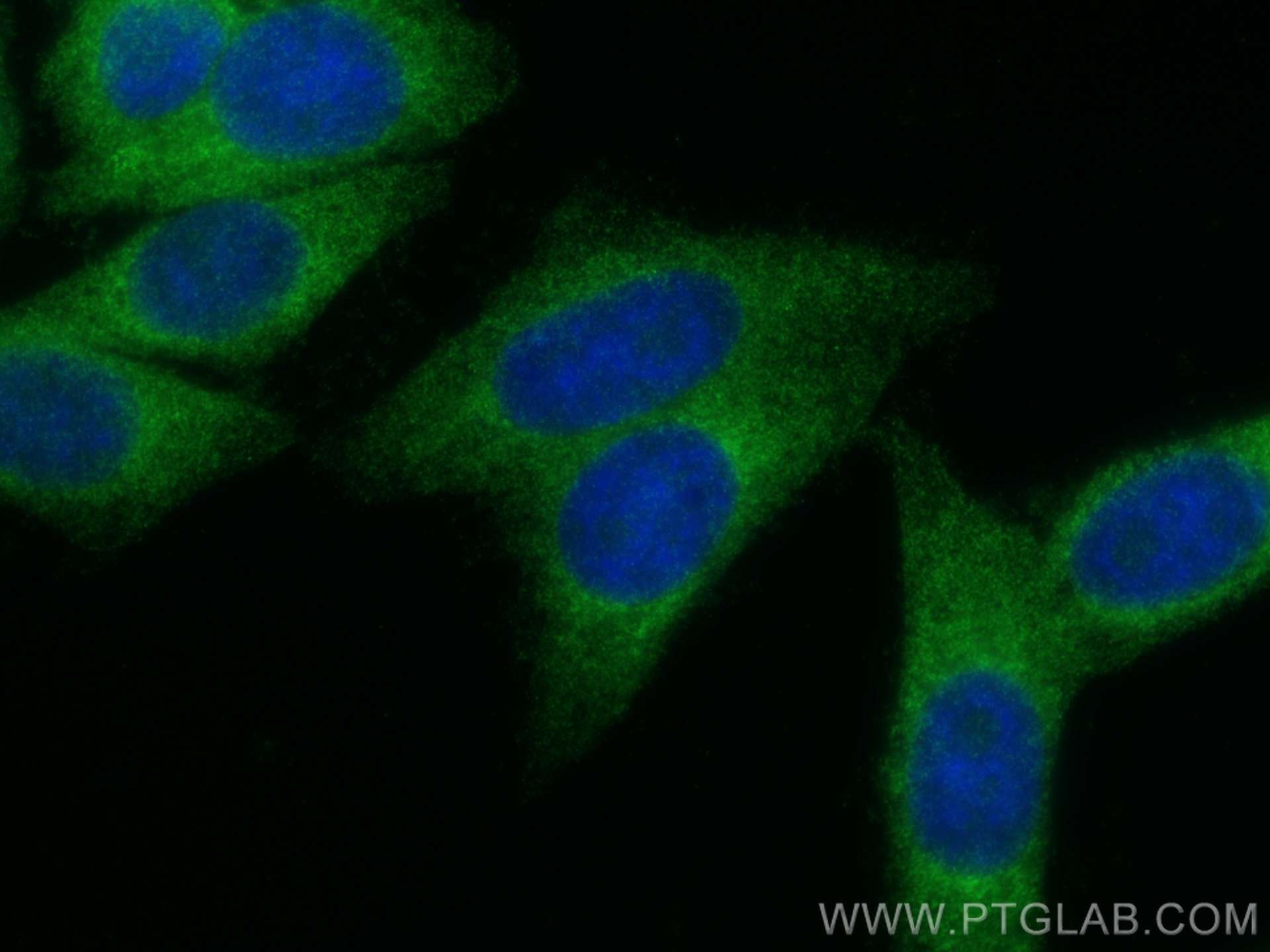 IF Staining of HepG2 using 11027-1-AP