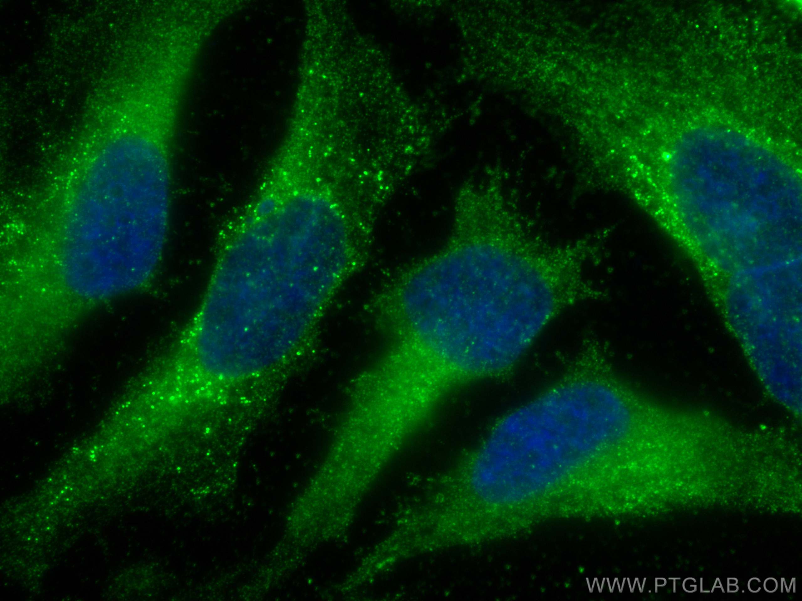 IF Staining of HeLa using 60058-1-Ig (same clone as 60058-1-PBS)