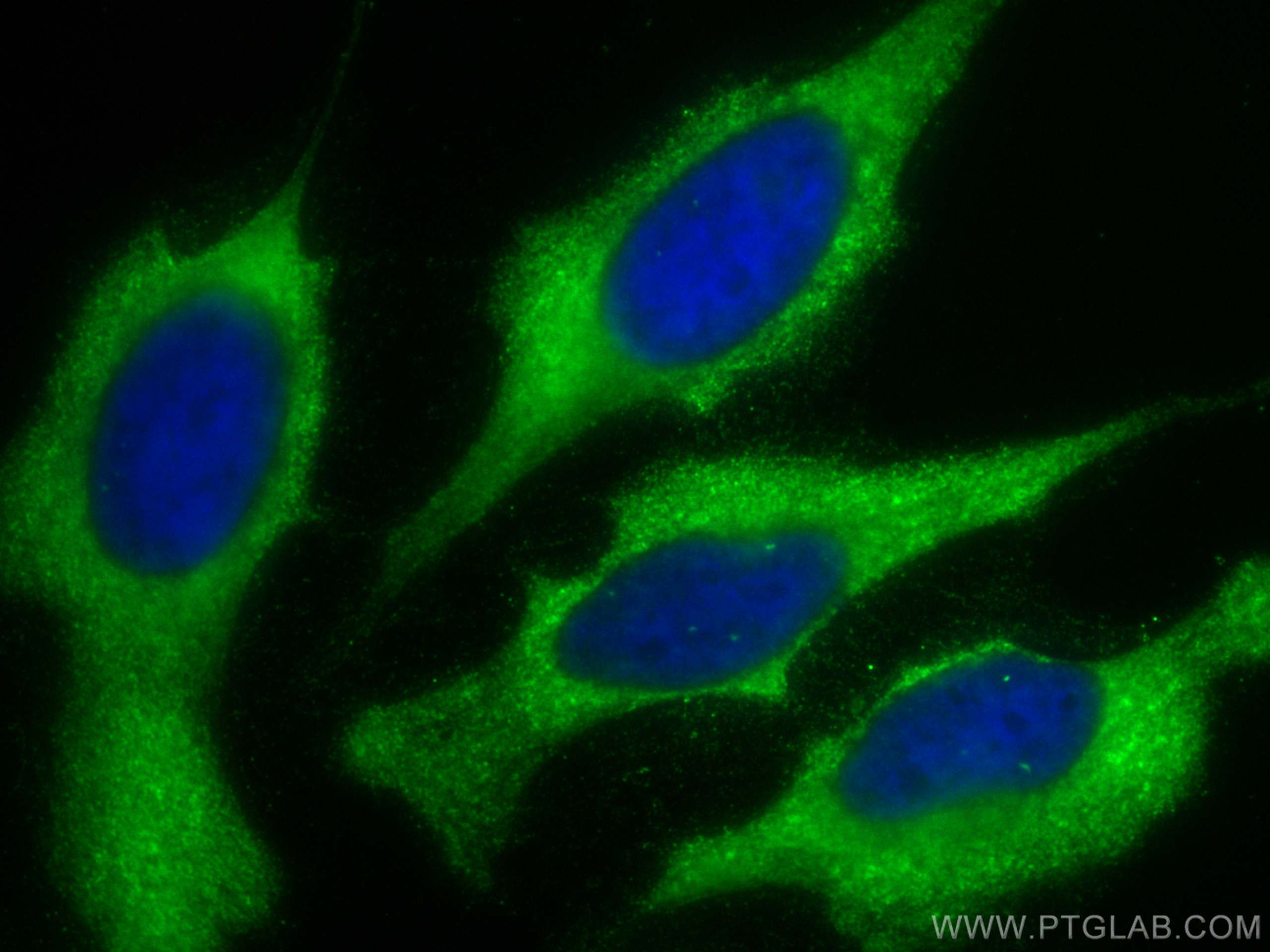 IF Staining of HeLa using CL488-60058