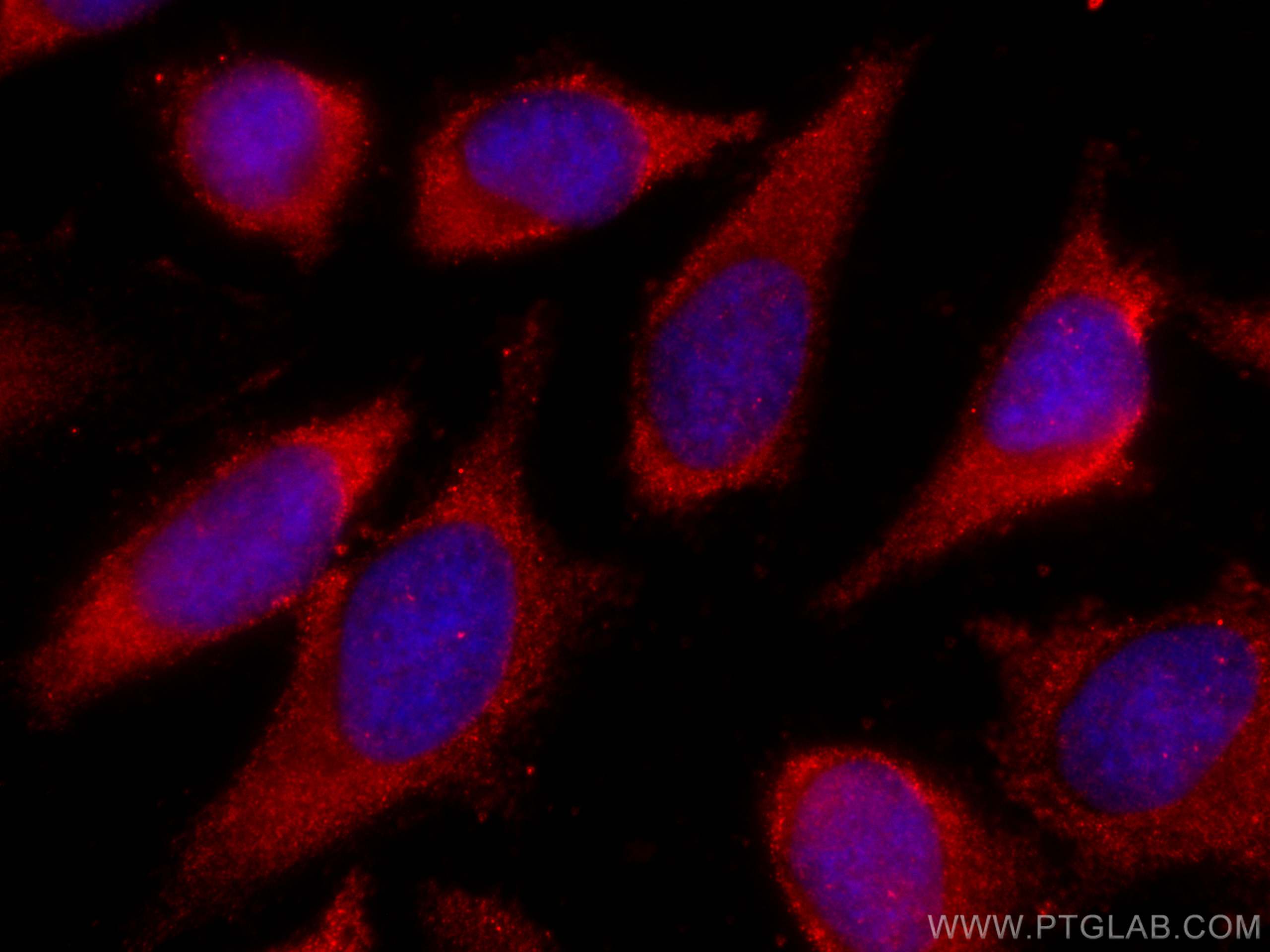 IF Staining of HeLa using CL594-60058