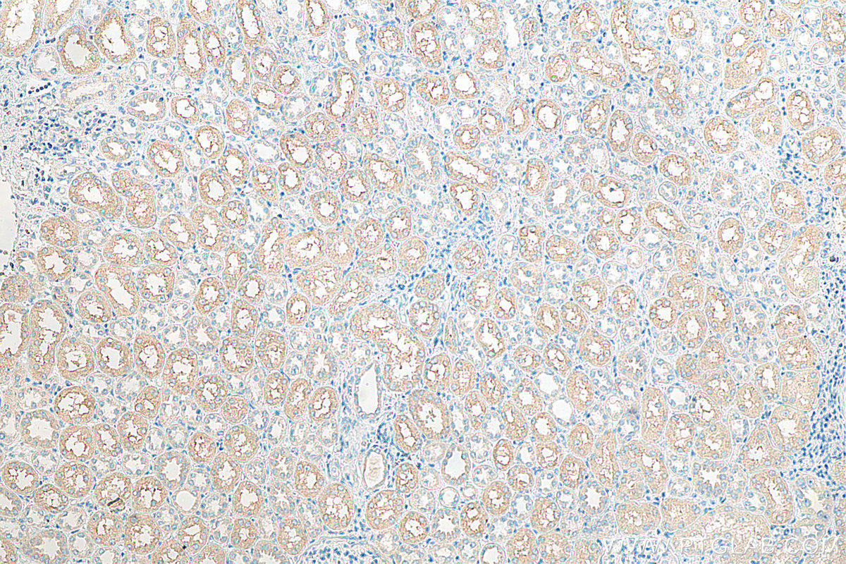 IHC staining of human kidney using 13143-1-AP (same clone as 13143-1-PBS)