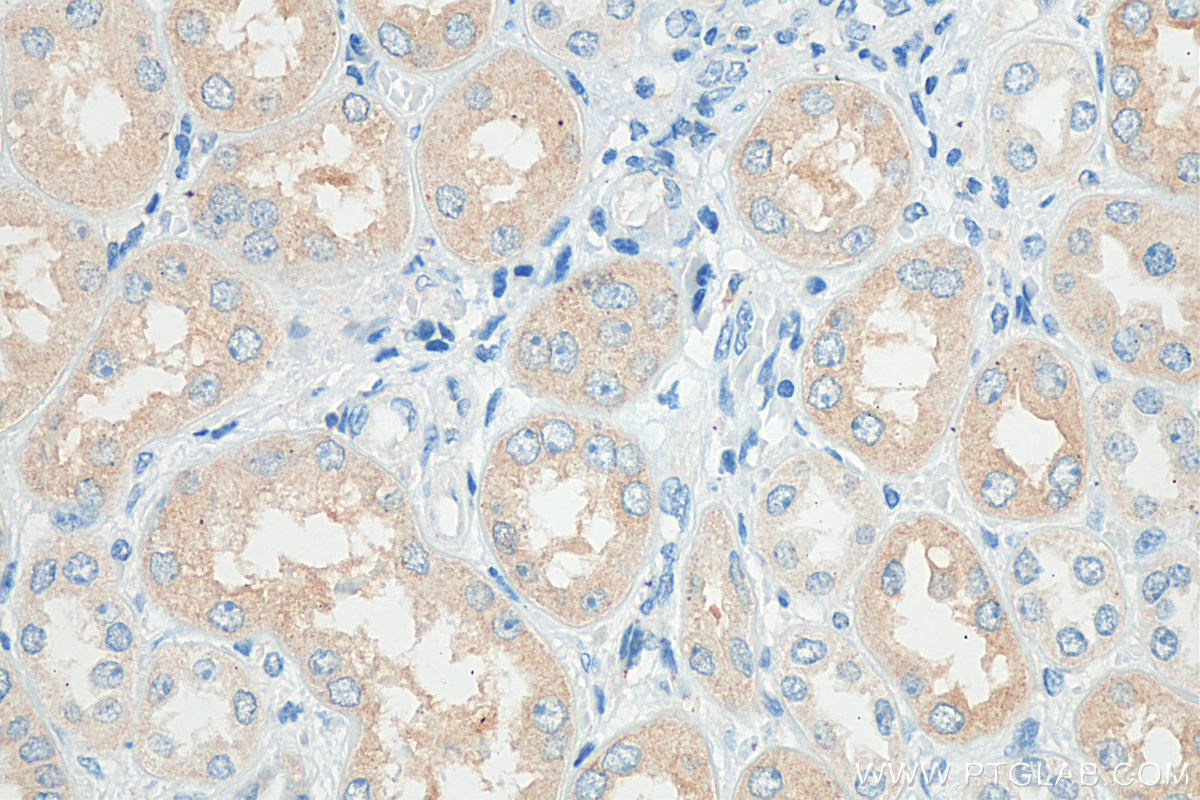 IHC staining of human kidney using 13143-1-AP (same clone as 13143-1-PBS)