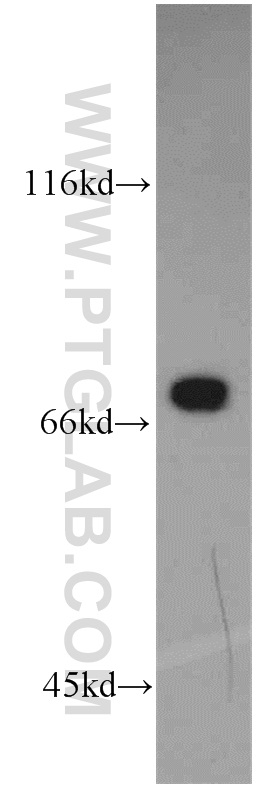 WB analysis of mouse small intestine using 55212-1-AP