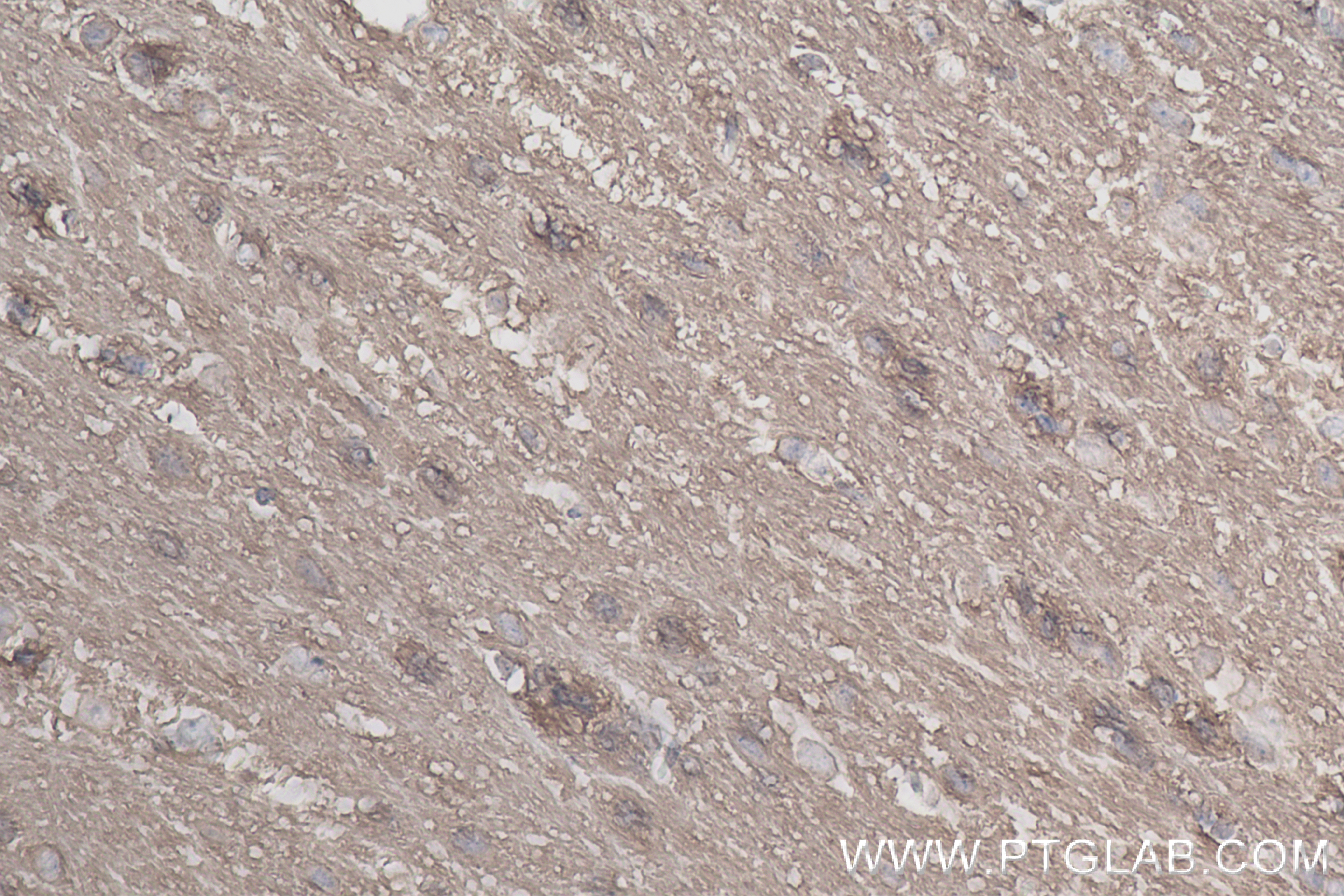 IHC staining of mouse brain using 84592-1-RR