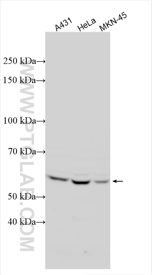 WB analysis using 12285-1-AP