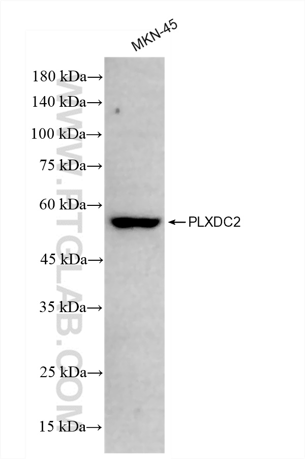 WB analysis of MKN-45 using 83449-4-RR (same clone as 83449-4-PBS)