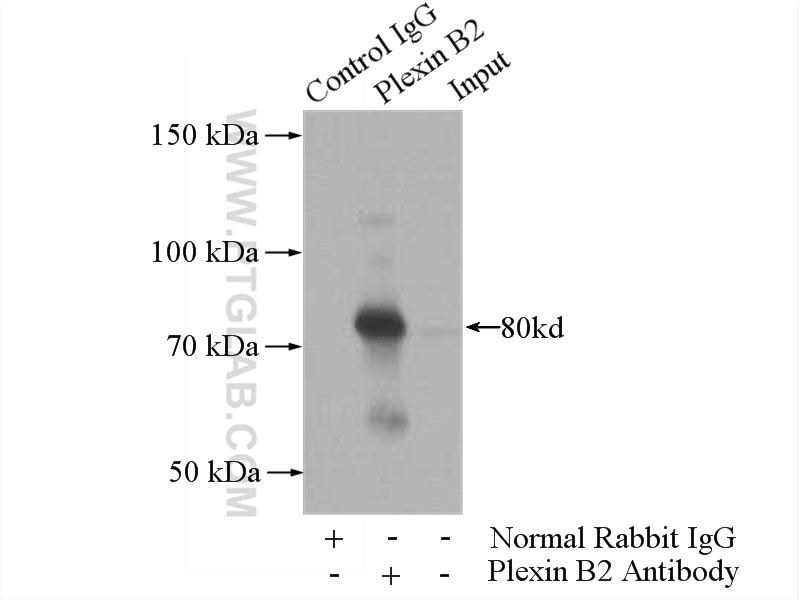 IP experiment of mouse liver using 10602-1-AP