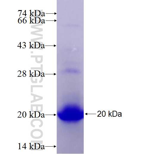 PLZF fusion protein Ag27547 SDS-PAGE