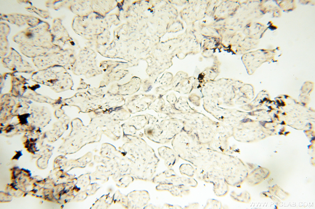 IHC staining of human placenta using 17705-1-AP