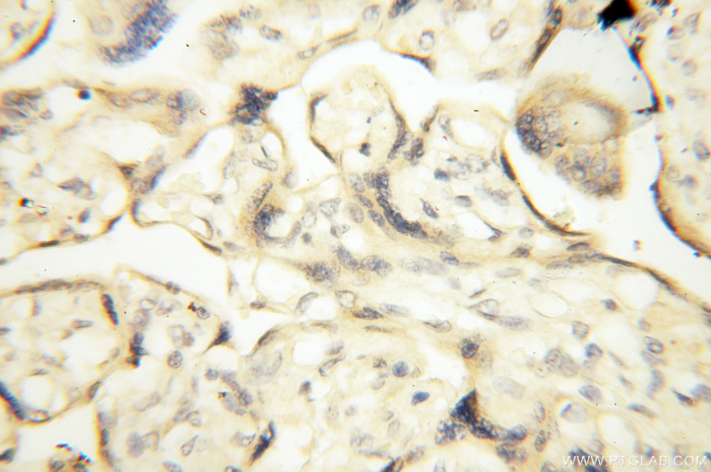 IHC staining of human placenta using 17705-1-AP