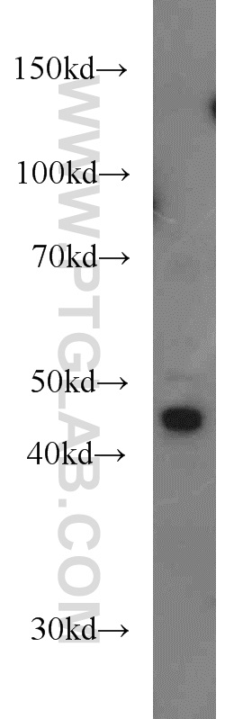 WB analysis of HeLa using 17705-1-AP