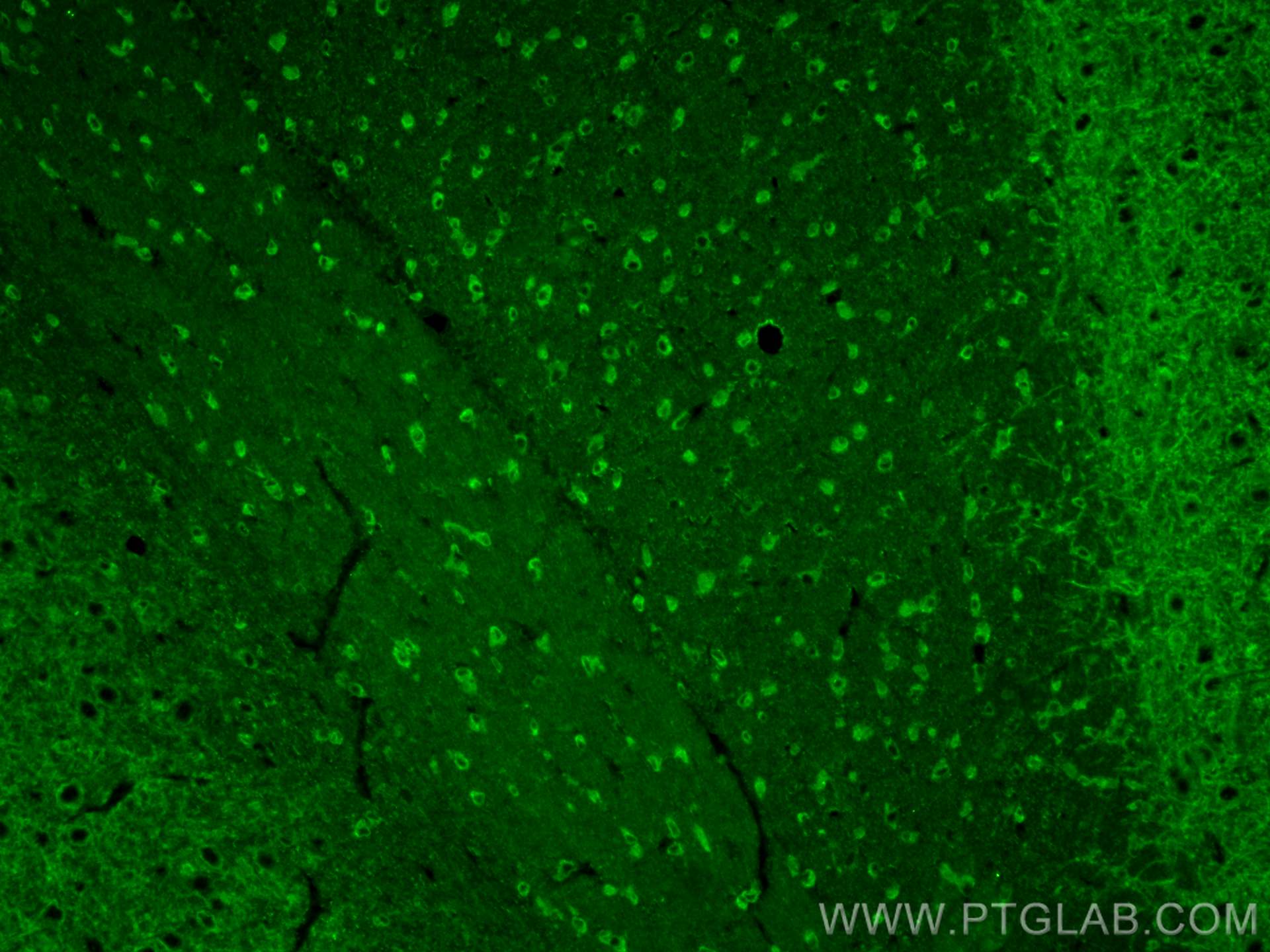 IF Staining of rat brain using 28423-1-AP