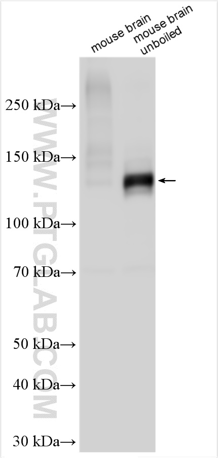 WB analysis using 28423-1-AP