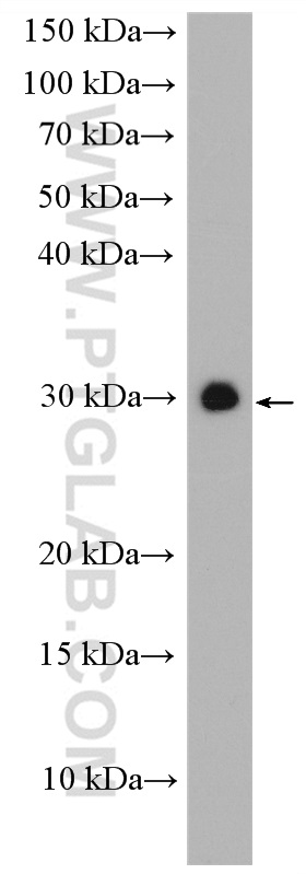 WB analysis of mouse brain using 11252-2-AP