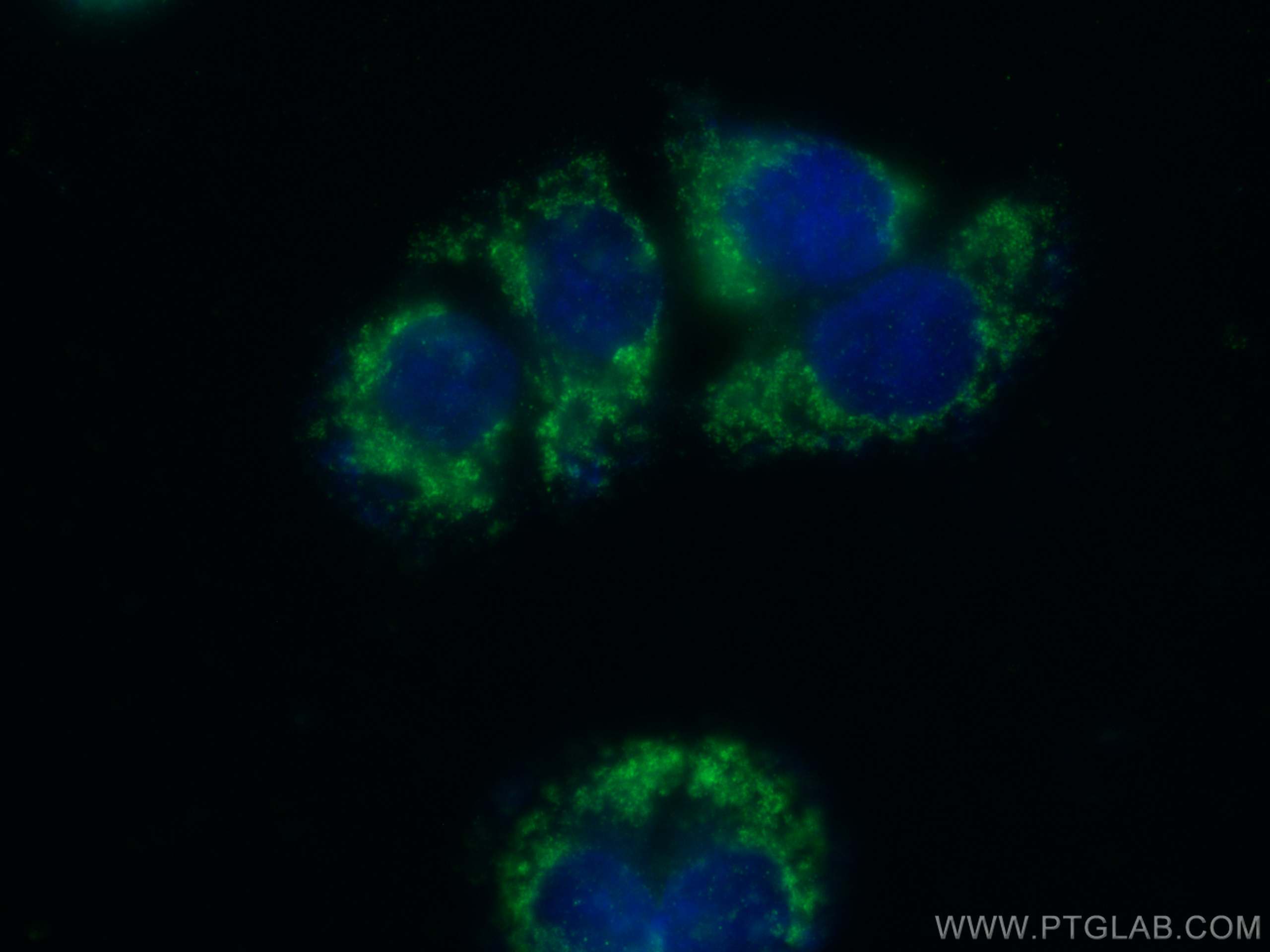 IF Staining of T-47D using 26536-1-AP