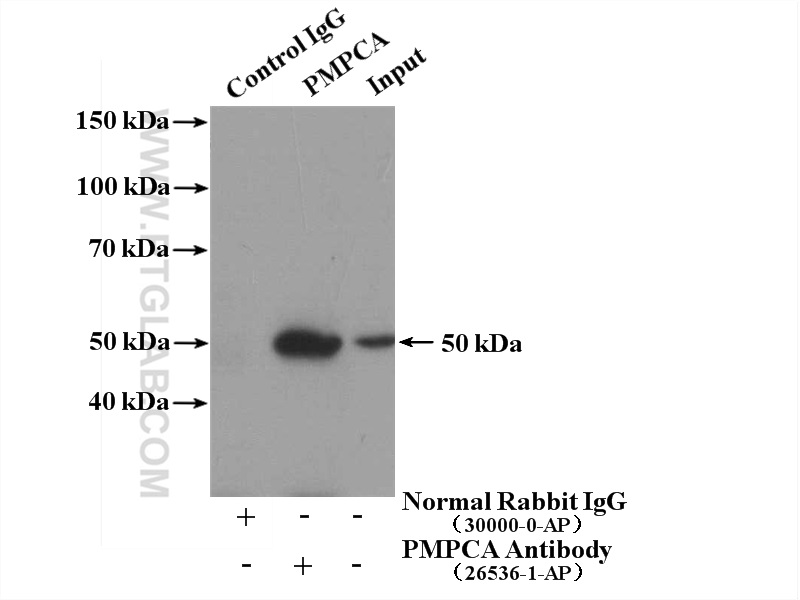 IP experiment of MDA-MB-453s using 26536-1-AP