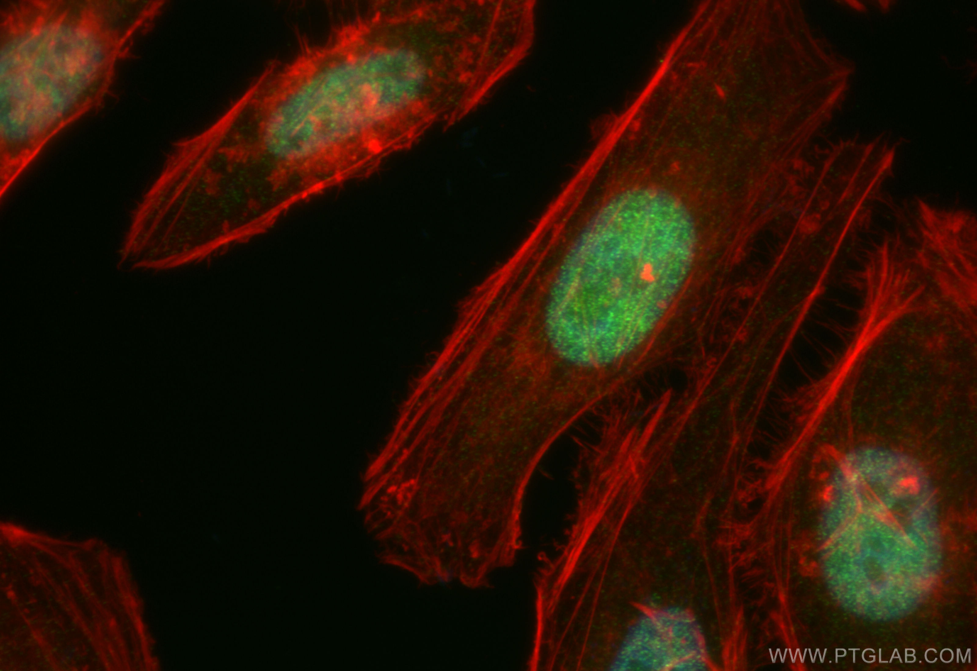 IF Staining of HeLa using 83456-6-RR