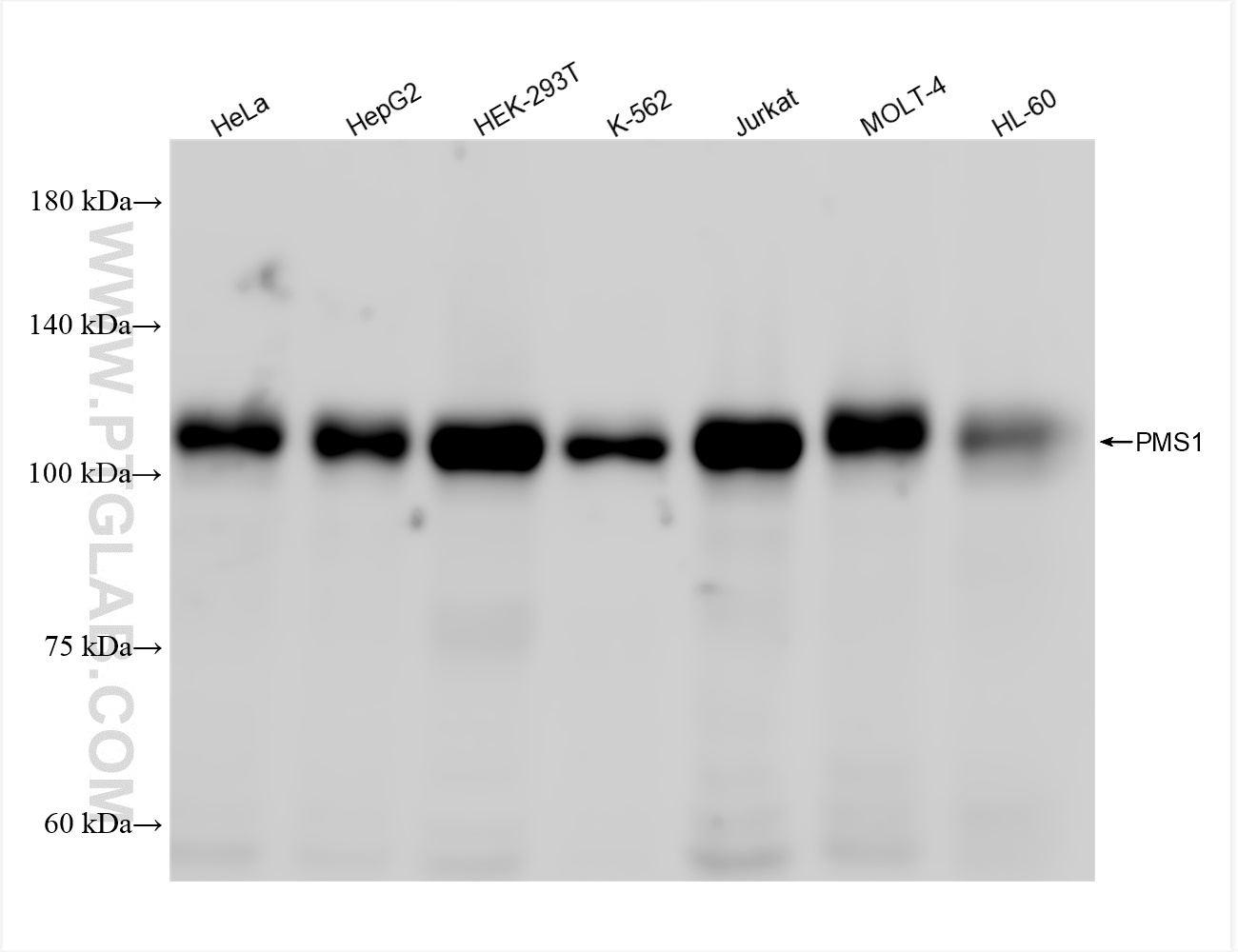 WB analysis using 83456-6-RR