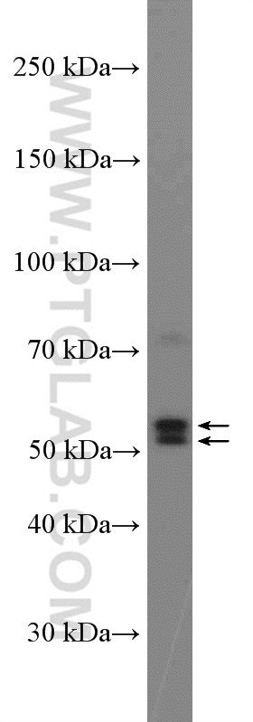 Pancreatic Lipase