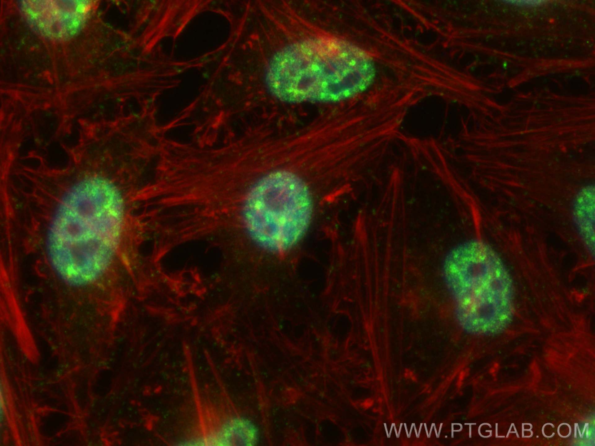 IF Staining of HeLa using 18266-1-AP