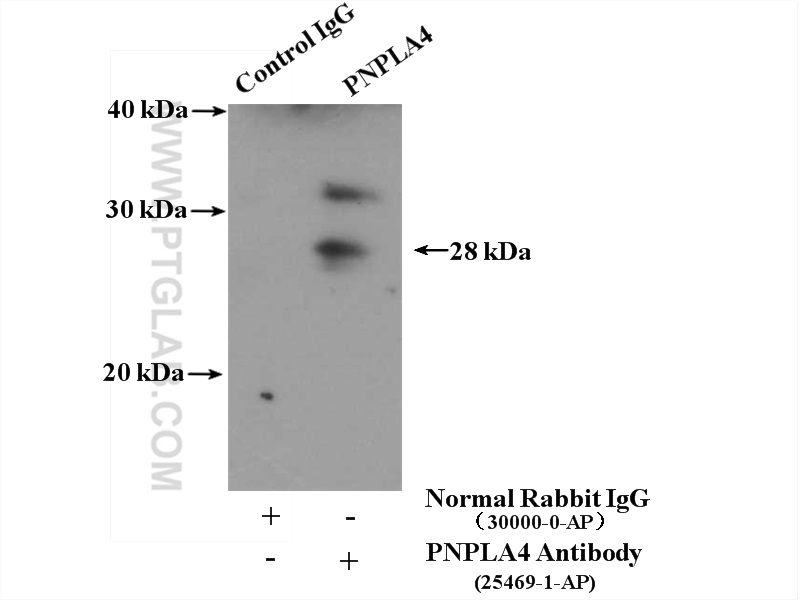 IP experiment of HeLa using 25469-1-AP (same clone as 25469-1-PBS)