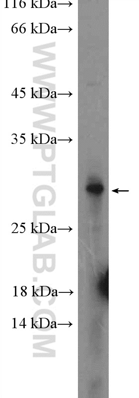 WB analysis of HeLa using 25469-1-AP (same clone as 25469-1-PBS)