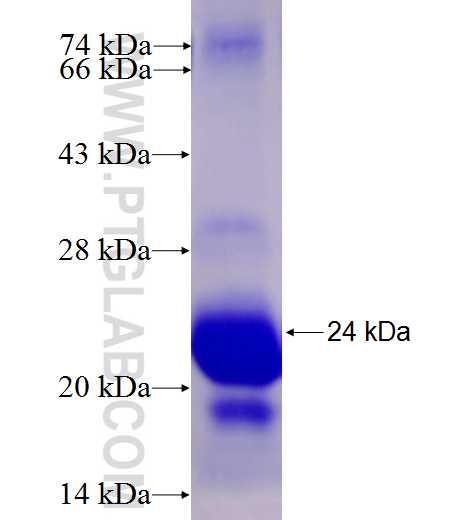 PNPLA7 fusion protein Ag27196 SDS-PAGE