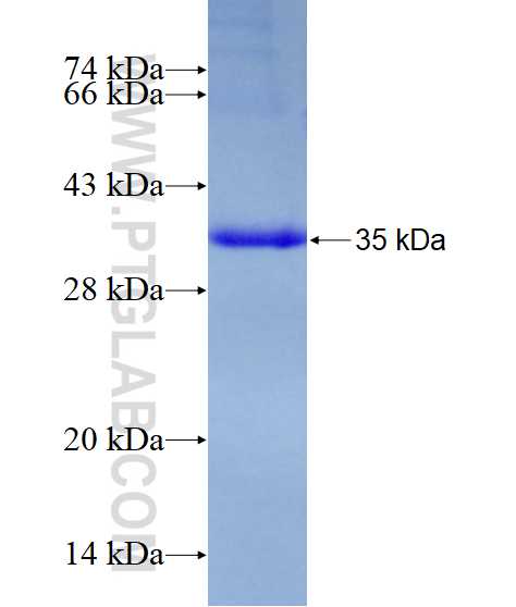 PNPLA8 fusion protein Ag22749 SDS-PAGE