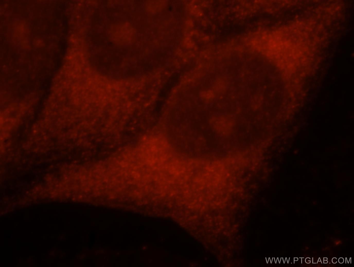 IF Staining of HeLa using 15552-1-AP