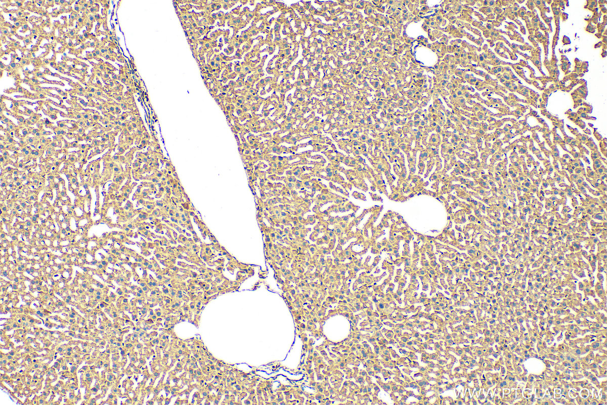 IHC staining of mouse liver using 14929-1-AP