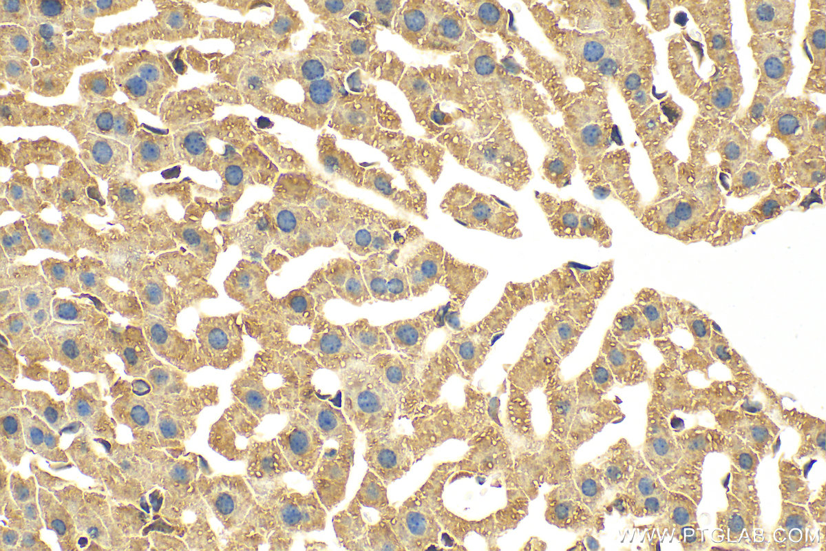 IHC staining of mouse liver using 14929-1-AP