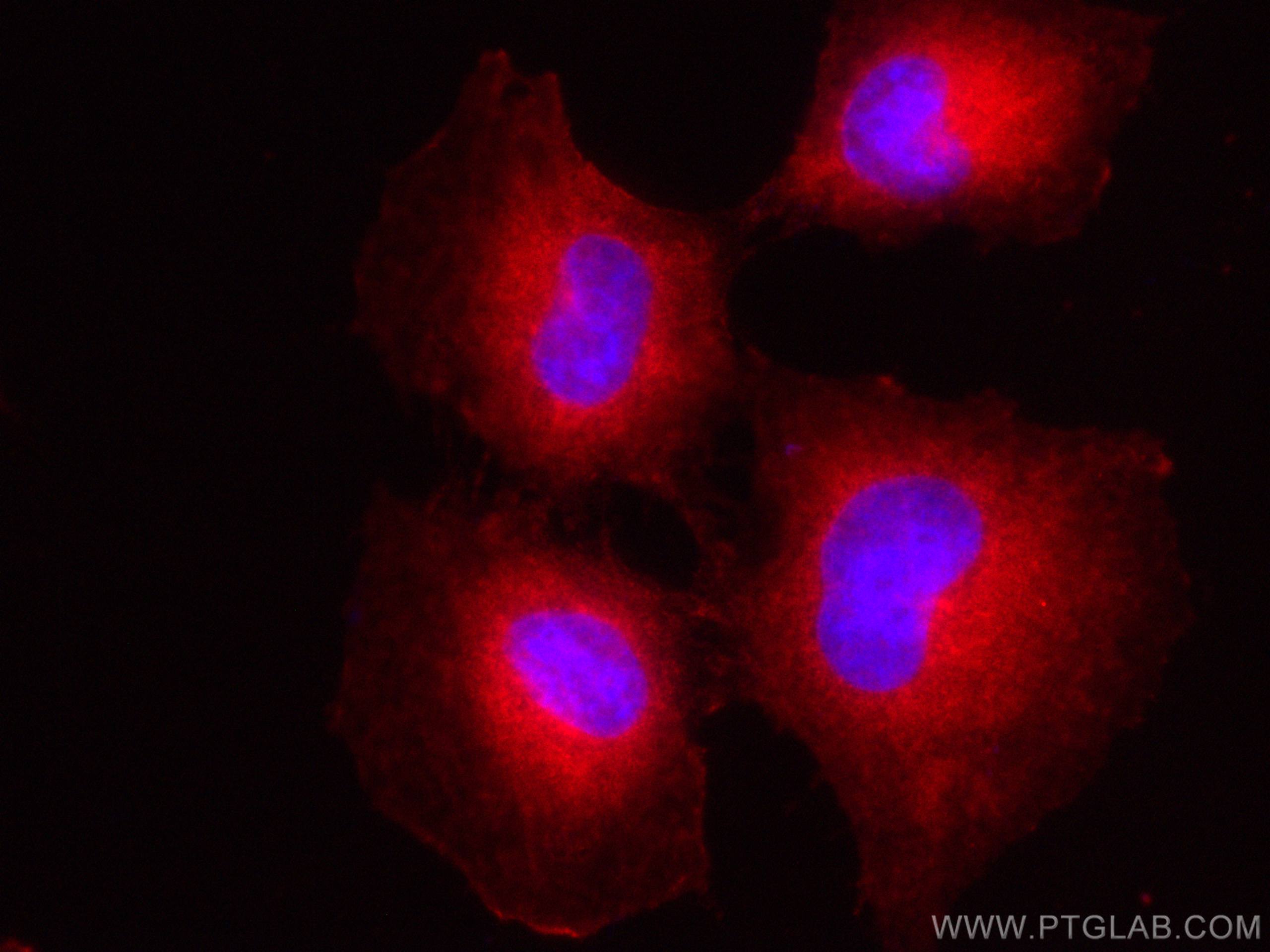 IF Staining of HUVEC using CL594-14929