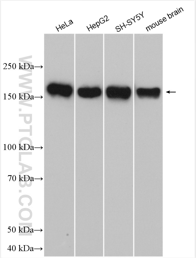 WB analysis using 30106-1-AP