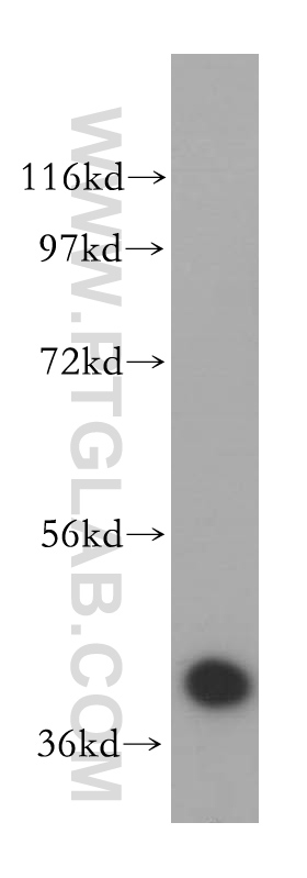 WB analysis of HeLa using 15080-1-AP