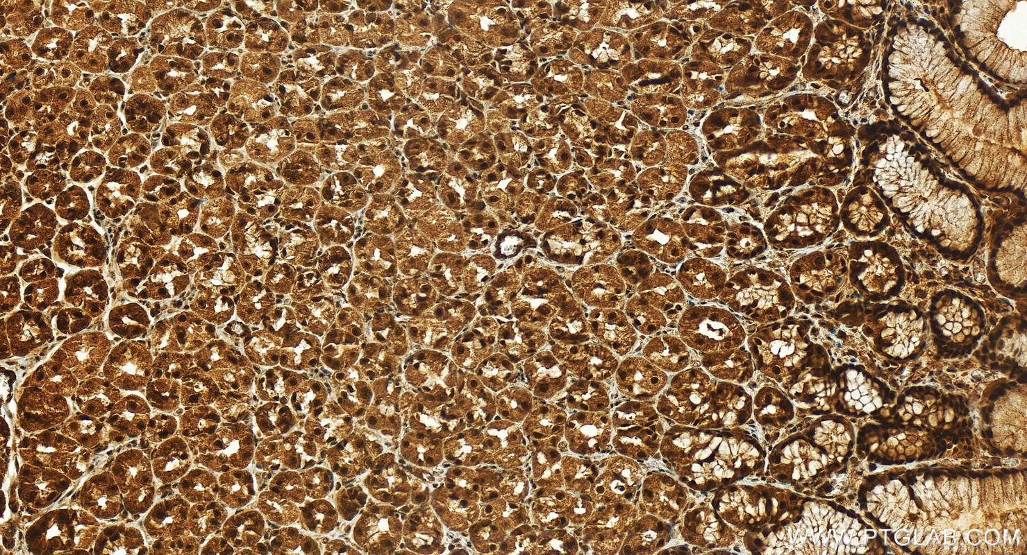 IHC staining of human stomach using 17466-1-AP