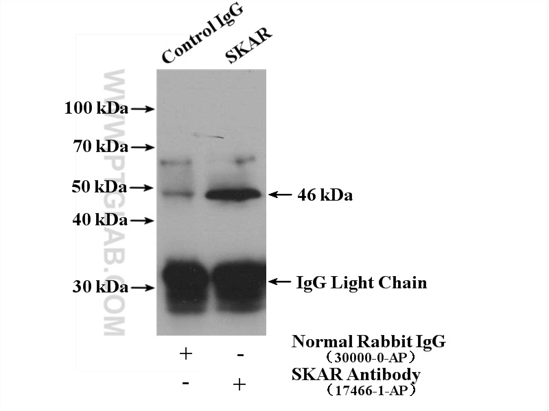 IP experiment of mouse brain using 17466-1-AP