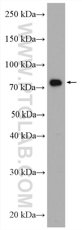 WB analysis of BxPC-3 using 28133-1-AP