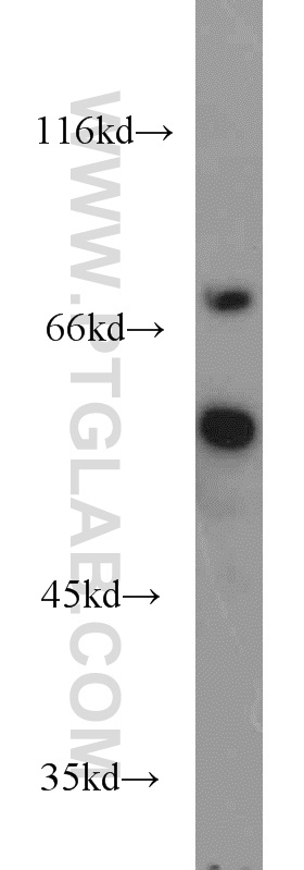 WB analysis of Jurkat using 14873-1-AP
