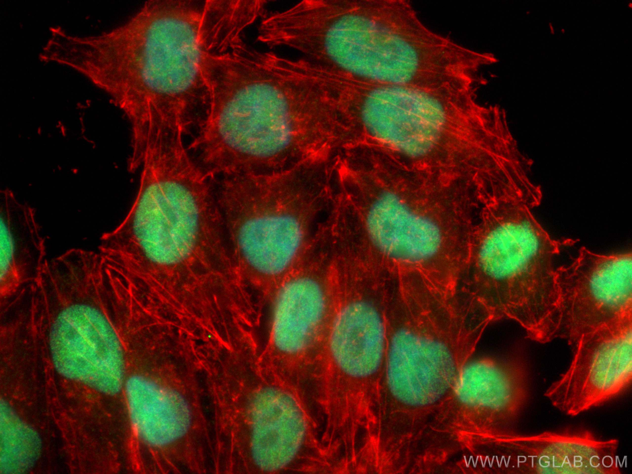 IF Staining of A375 using 28590-1-AP