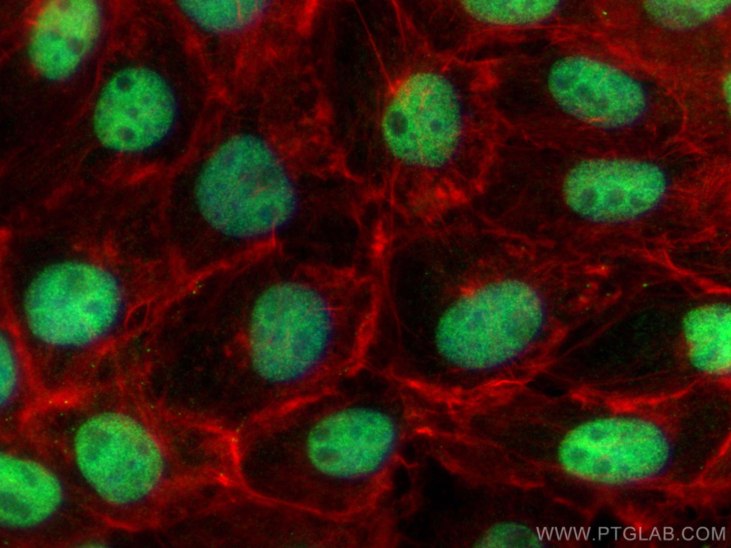 IF Staining of A431 using 28590-1-AP