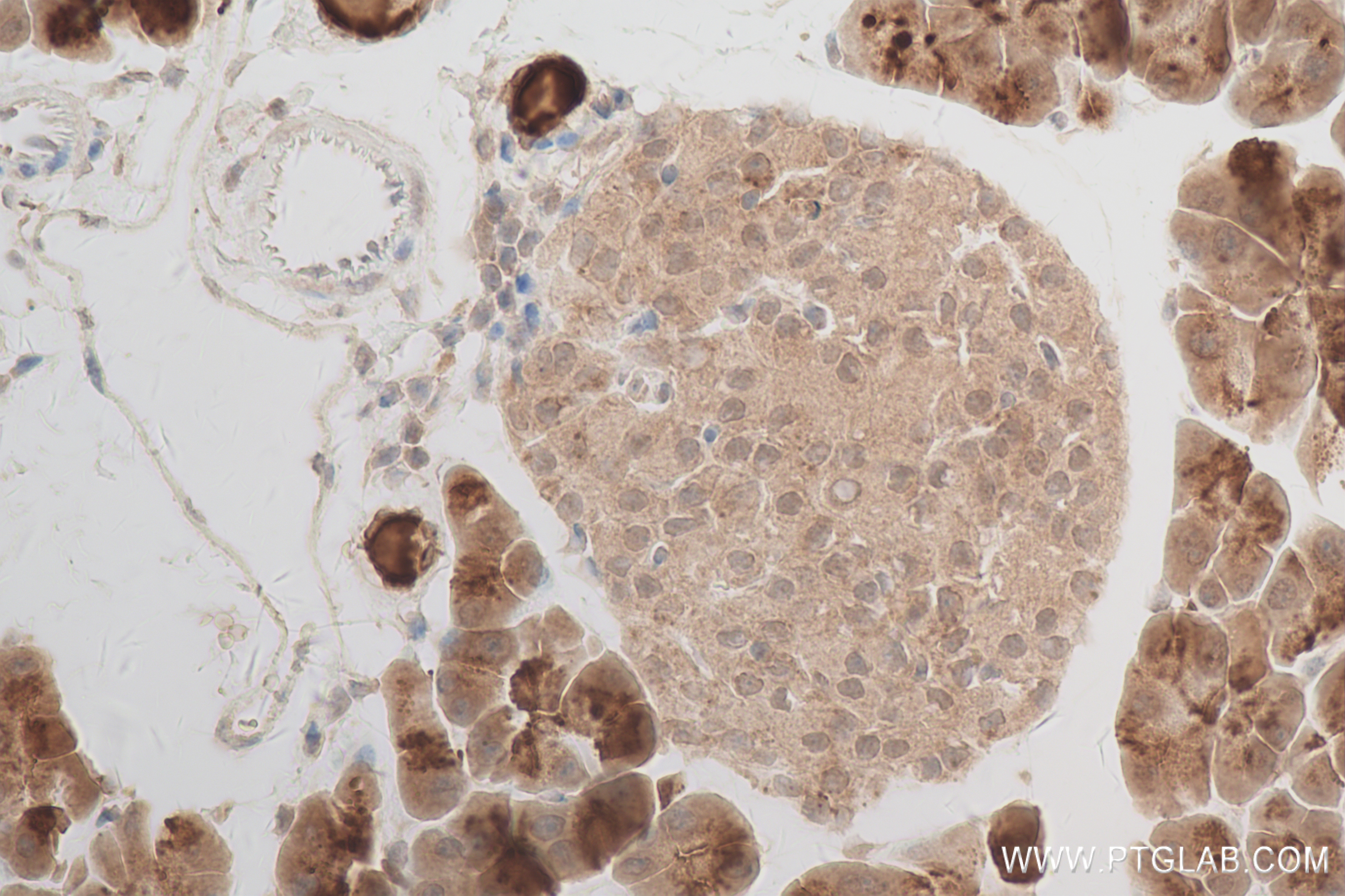 IHC staining of mouse pancreas using 84357-1-RR